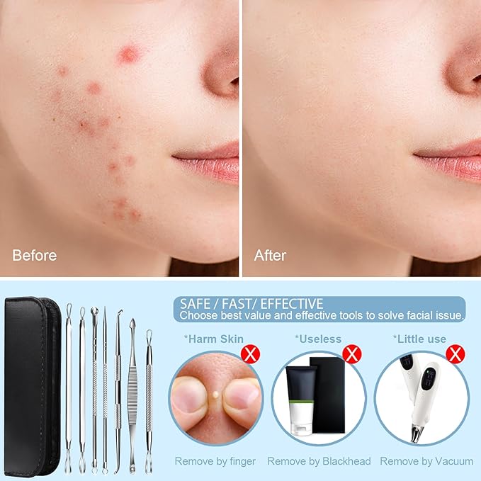 Teenitor 7 in 1 Pimple Popper Tool Kit Blackhead Remover Tools Blackhead Extractor, Pimple Extractor Pimple Popper Tool Zit Popper Tool Acne Tools Comedone Extractor Black Head Remover