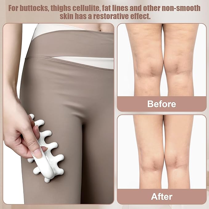 Vemoky Fascia Massage Tool Trigger Point Massage Tools Anti Blaster for Cellulite Massage Tool Reaching Deep Myofascial Tissue Throughout The Body Release Muscle Knot Reduction Cellulite