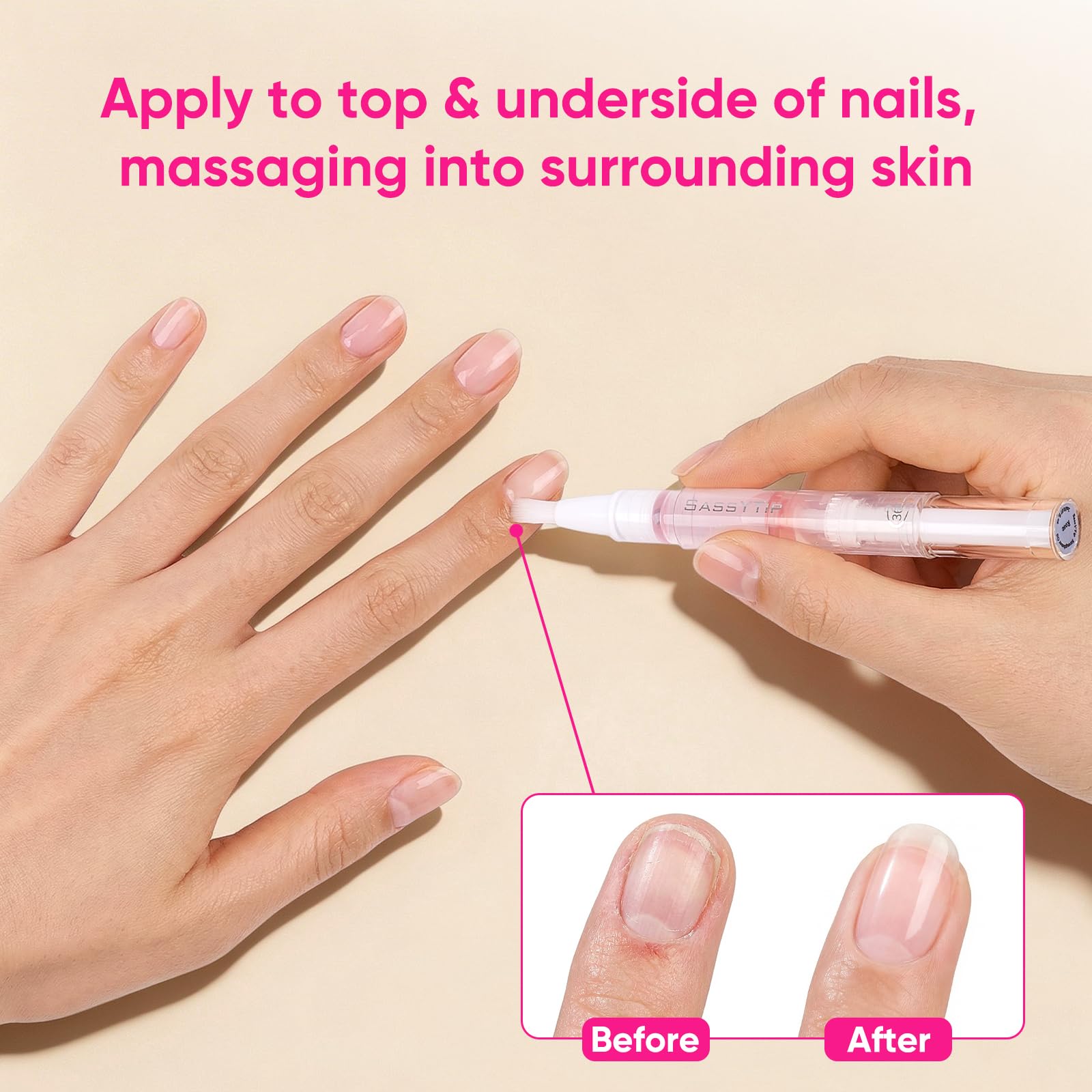 SASSYTIP Nail Strengthen Oil Pen | Fast-Absorbing Cuticle Oil with Biotin & Ginseng | For Brittle & Peeling Nails | Jasmine, Rose, Lemon Scents | Home, Office, Travel Use (3PCS)
