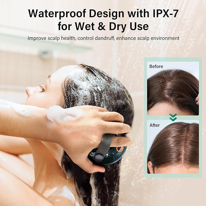 arboleaf Scalp Massager Electric, Portable Head Massager Scalp Stress Relax, Waterproof 6 in 1 Hair Massage with 8 Removable Claws, Rechargeable Hair Head Scratcher, Gift for Dad Mom