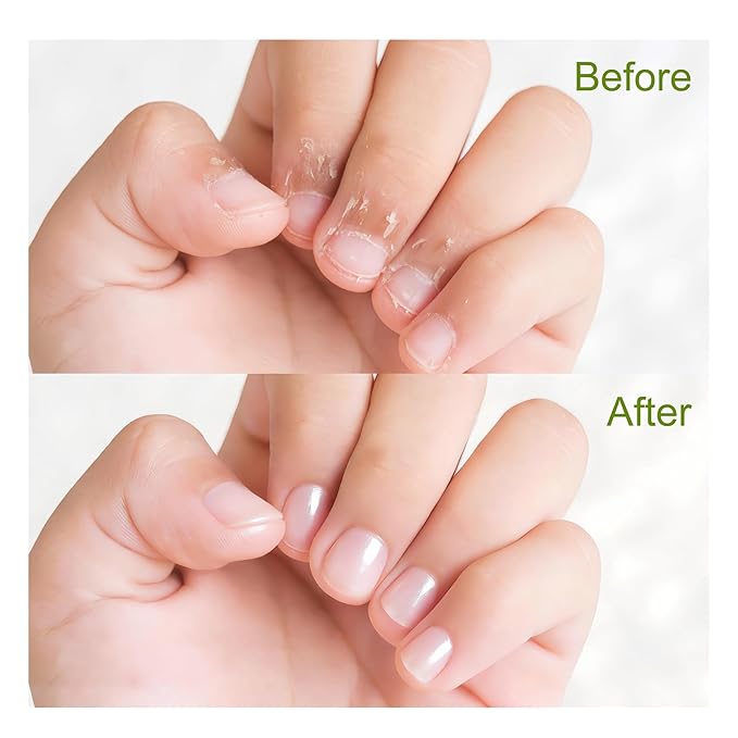 NOVAL Roll on Cuticle Oils with Tea Tree Oil, Easy Rollerball Application, Fresh Mint Scent, Nail Moisture, Natural Ingredients, 0.34 fl.oz