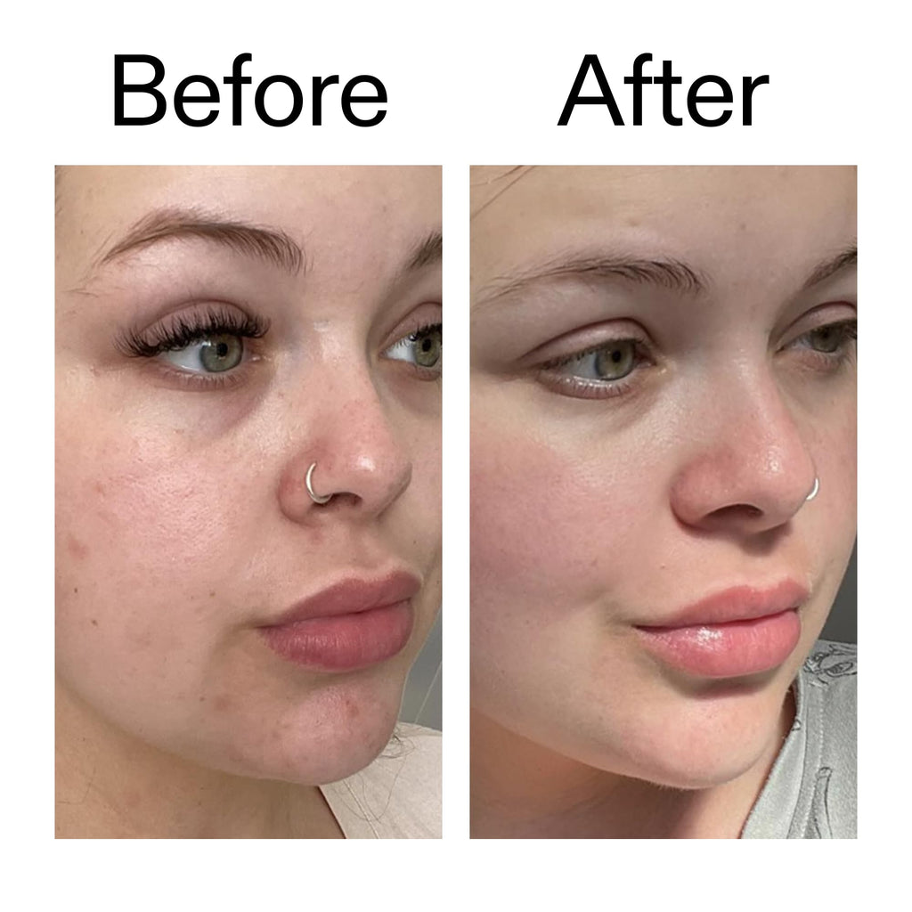The INKEY List Omega Water Cream, Oil-Free Face Moisturiser, Lightweight Gel, Vegan Friendly Skincare, Suitable For Blemish Prone Skin