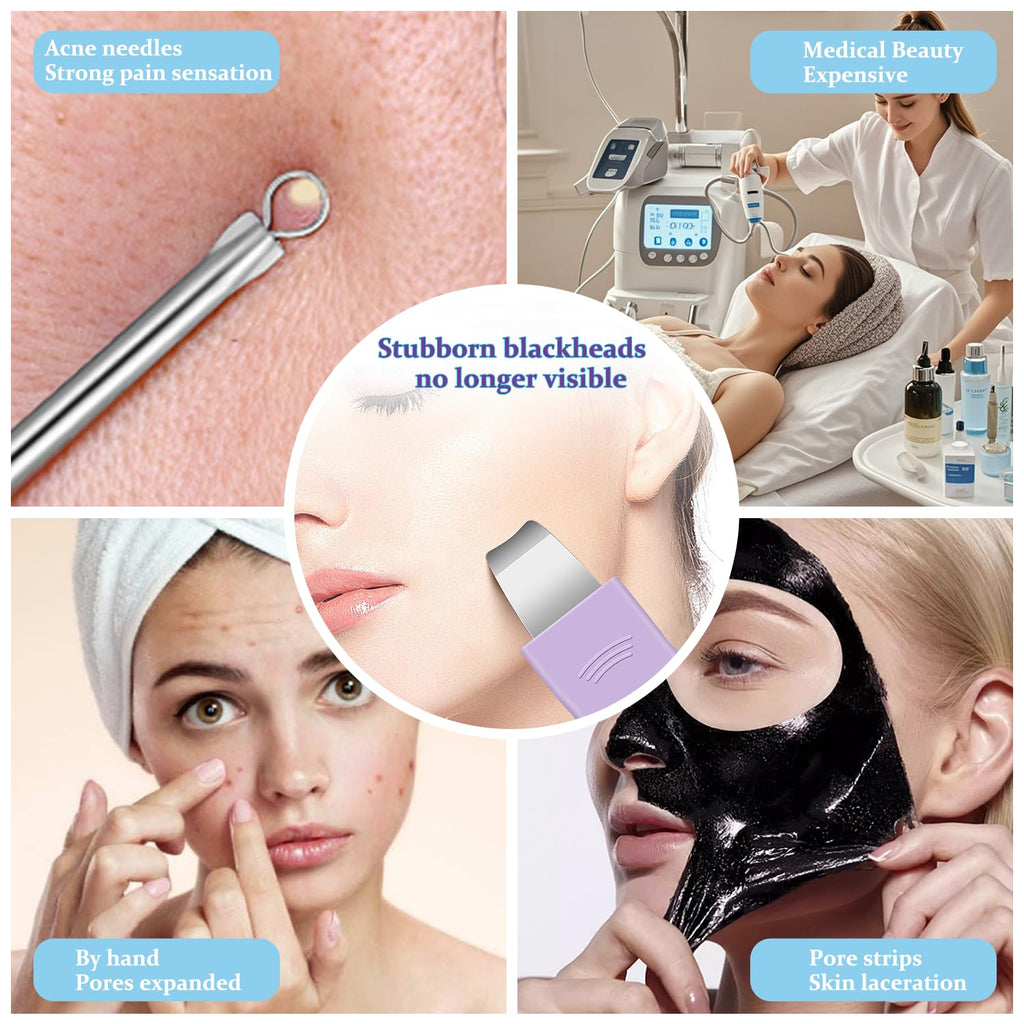 Sichy Blackhead Remover Tool,Silicone Face Scrubber, 2 in 1 Nose Pore Scraper for Deep Cleansing,Face Skin Spatula, Nose Black Head Remover, Pore Cleaner Skin Care Tool for Men Women Gifts