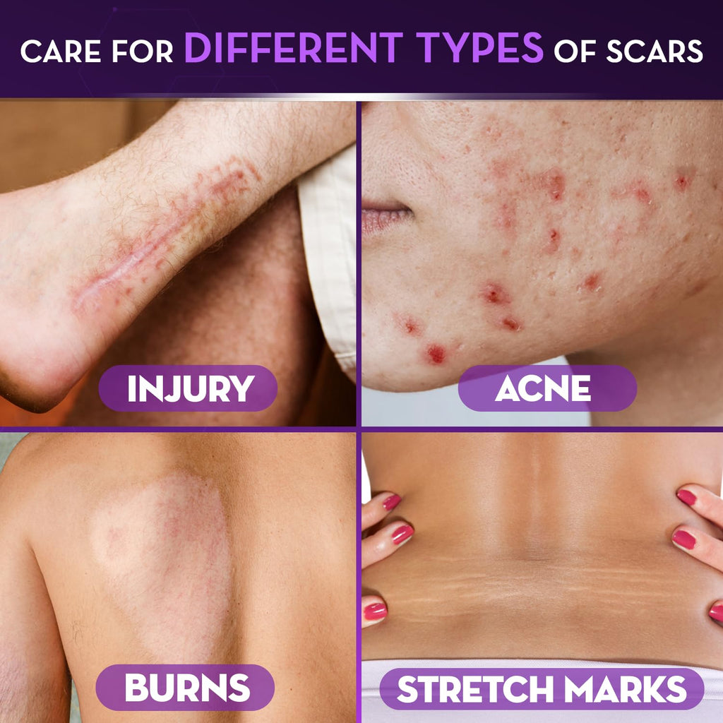 Cicatricure Advanced Scar Gel, Proven Results in 2 Weeks, 1 oz (28 g), 2pk