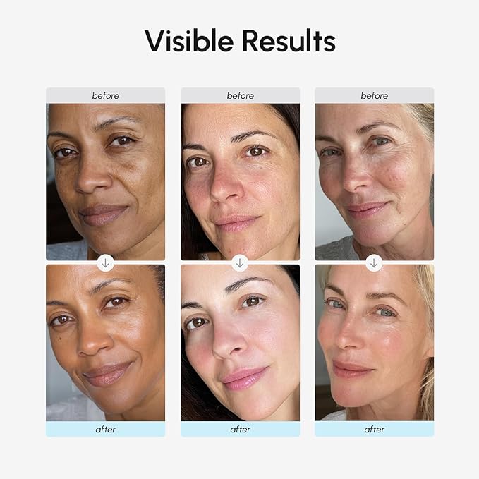 MAREE Face Moisturizer Retinol Cream for Face – Daily Wrinkle Cream for Women – Anti-Aging Face Cream – Facial Moisturizer with Collagen – Crema Hidratante Para la Cara for Skin Tightening