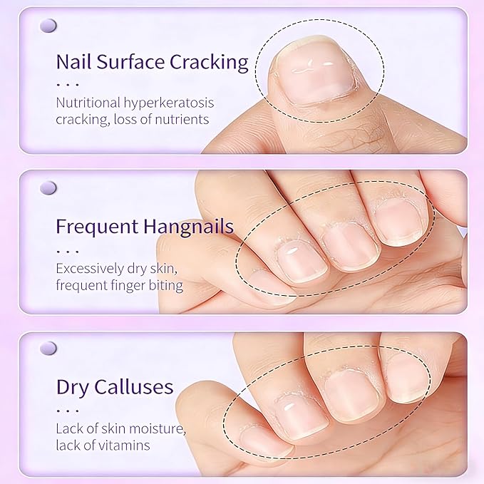 KAHSOSE 3-in-1 Nail Care Pen Set, 3Pcs Cuticle Oil Pusher Pen with Ceramic Tip, Nail Oil Pen for Dry Cuticles & Hangnails, Moisturizing Nail Conditioning Pen for Nails