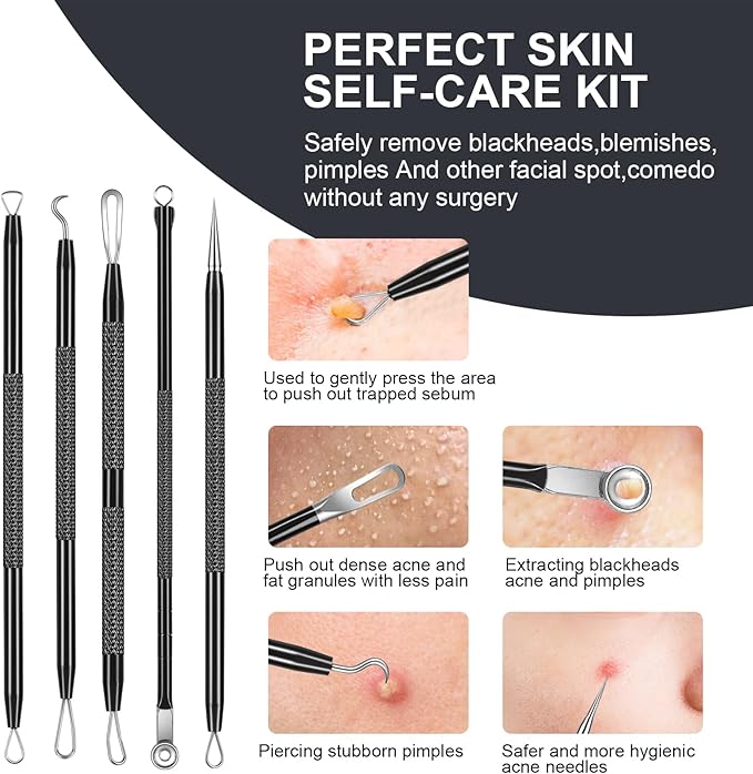 Meidaier 7Pcs Blackhead Remover Kit, Stainless Steel Acne Comedone Extractor with 10X Magnifying Glass & 20 75% Alcohol Pads, Pimple Whitehead Blemish Removal, Anti-Slip Handle & Storage Box