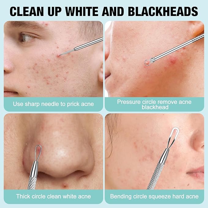 MUIIGOOD 3Pcs Blackhead Remover Pimple Popper Tool Kit Pimple Extractor Acne Treatment Surgical Grade Blackhead Comedone Removal Popper Tool Cleaning Brush for Face Nose Lips