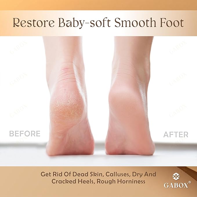 GABOX Nano Glass Pro Foot File - Callus Remover for Feet - Heel Foot Scrubber Dead Skin Exfoliator - Pedicure SPA Tool for Women & Men - Removedor de Callos en Los Pies - Crystal Gold