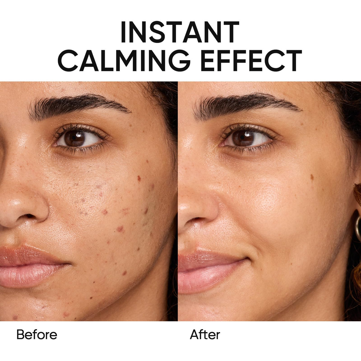 SKINTIFIC Mugwort Clay Stick Face Mask with Centella & Salicylic Acid