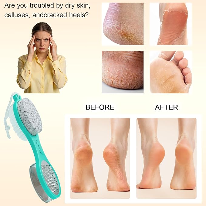 YIOYOODA Foot File Callus Remover 5-in-1, 2 Pcs Feet Scraper Pedicure Tools with Pumice Stone, Scrubber Brush, Stainless Steel Foot Rasp and Sand Paper Debris Catcher, Multi Purpose, Pink Cyan