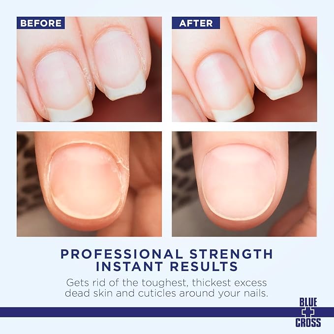 Cuticle Remover & Softener Liquid for Nails – Blue Cross Professional Nail Care with Lanolin, Hydrating Treatment for Dry Cuticles & Hangnails, Made in USA, 32oz