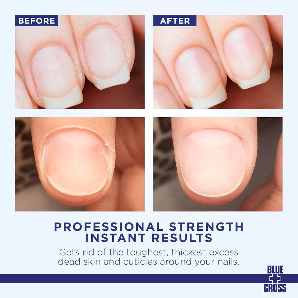 Blue Cross Cuticle Remover & Softener with Lanolin for Nails, 32 oz