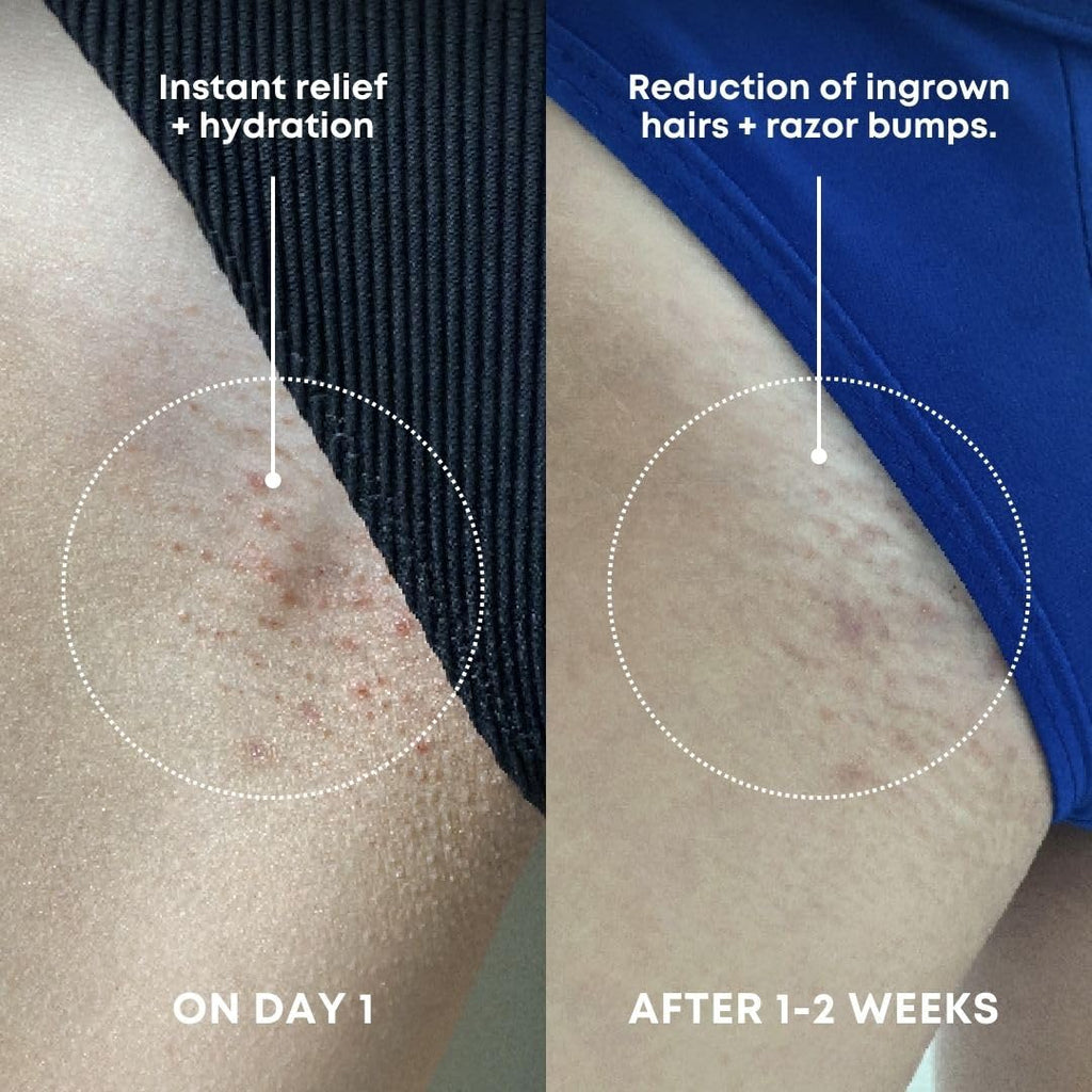 Bushbalm Ingrown Hair Exfoliating Scrub - Reduces Appearance of Ingrown Hairs and Razor Bumps, Soothes Skin and Post-Shave Redness - Nude, 236 ml