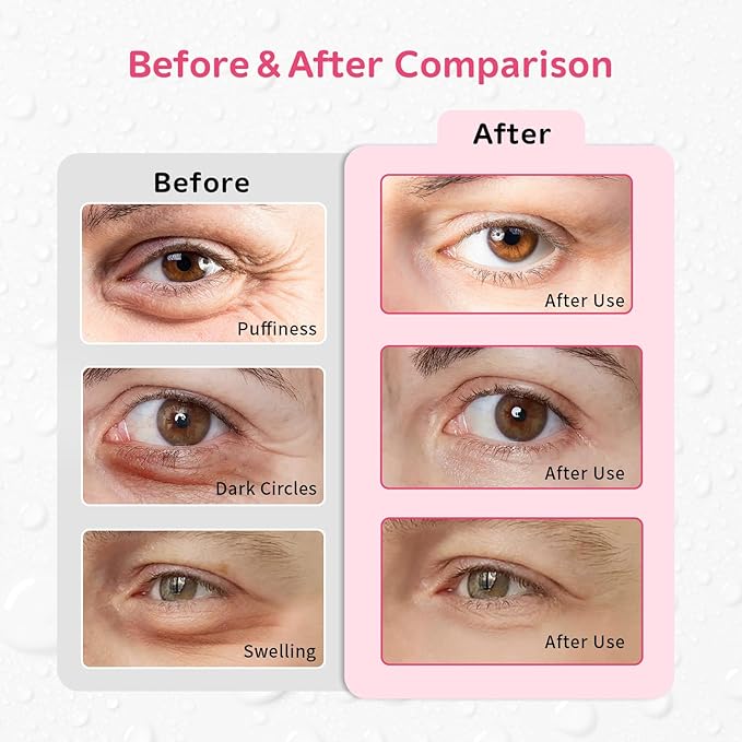 4PCS Gel Eye Ice Pack Set, Cold & Hot Compress, Reusable Cooling Gel Pads for Strain Relief, Relaxation, SPA and Sleep (4 Strawberries)