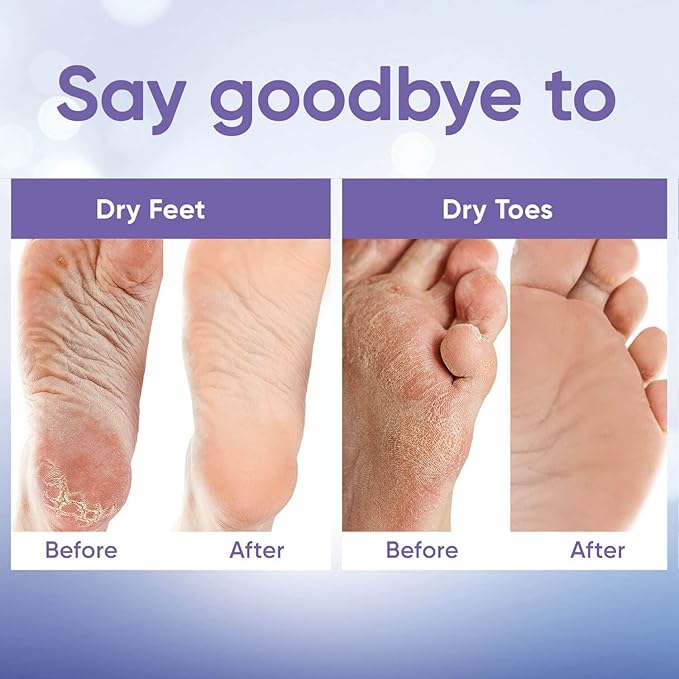 CÉLOR Foot Peeling Mask for Dry Cracked Feet | Foot Mask to Exfoliate Rough, Cracked, Dry Feet, Calluses for Soft Baby Feet Results | Made with Aloe Vera Extract for Women & Men (3 Pairs) | Lavender