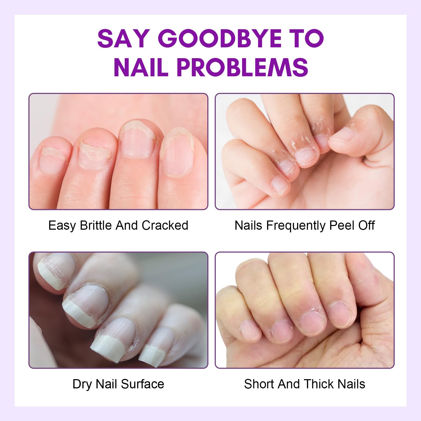 Makartt Cuticle Oil Pen Nail Care: Repair and Softener with Vitamin E, Moisturizer Kit for Acrylic Nails, Art Accessory for Manicure and Pedicure, DIY Home Salon Use
