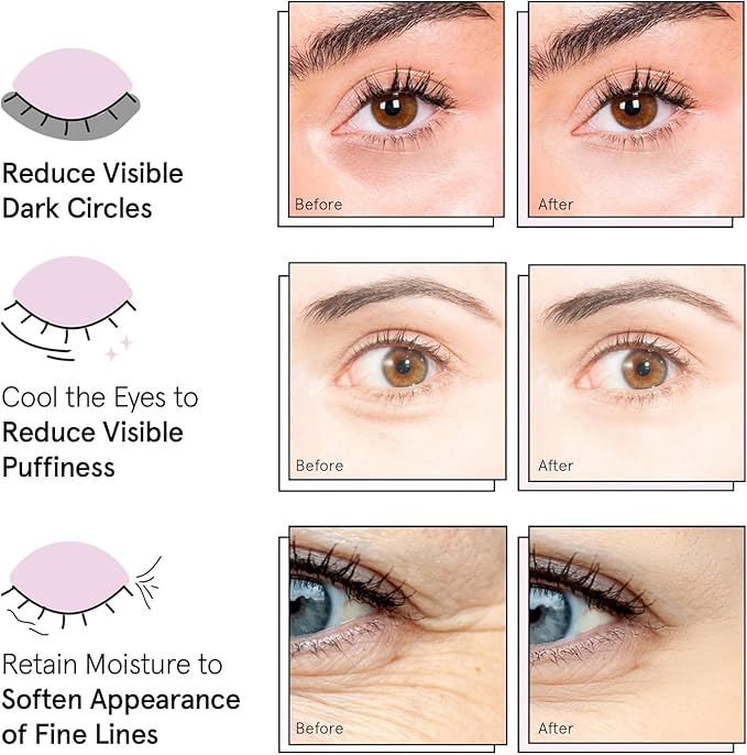 grace & stella Under Eye Patches (12 pairs) Eye Masks for Puffy Eyes and Dark Circles - Gifts for Women, Bridesmaids, Birthdays, Bachelorette Party, Self Care Gifts for Women - Vegan Cruelty-Free