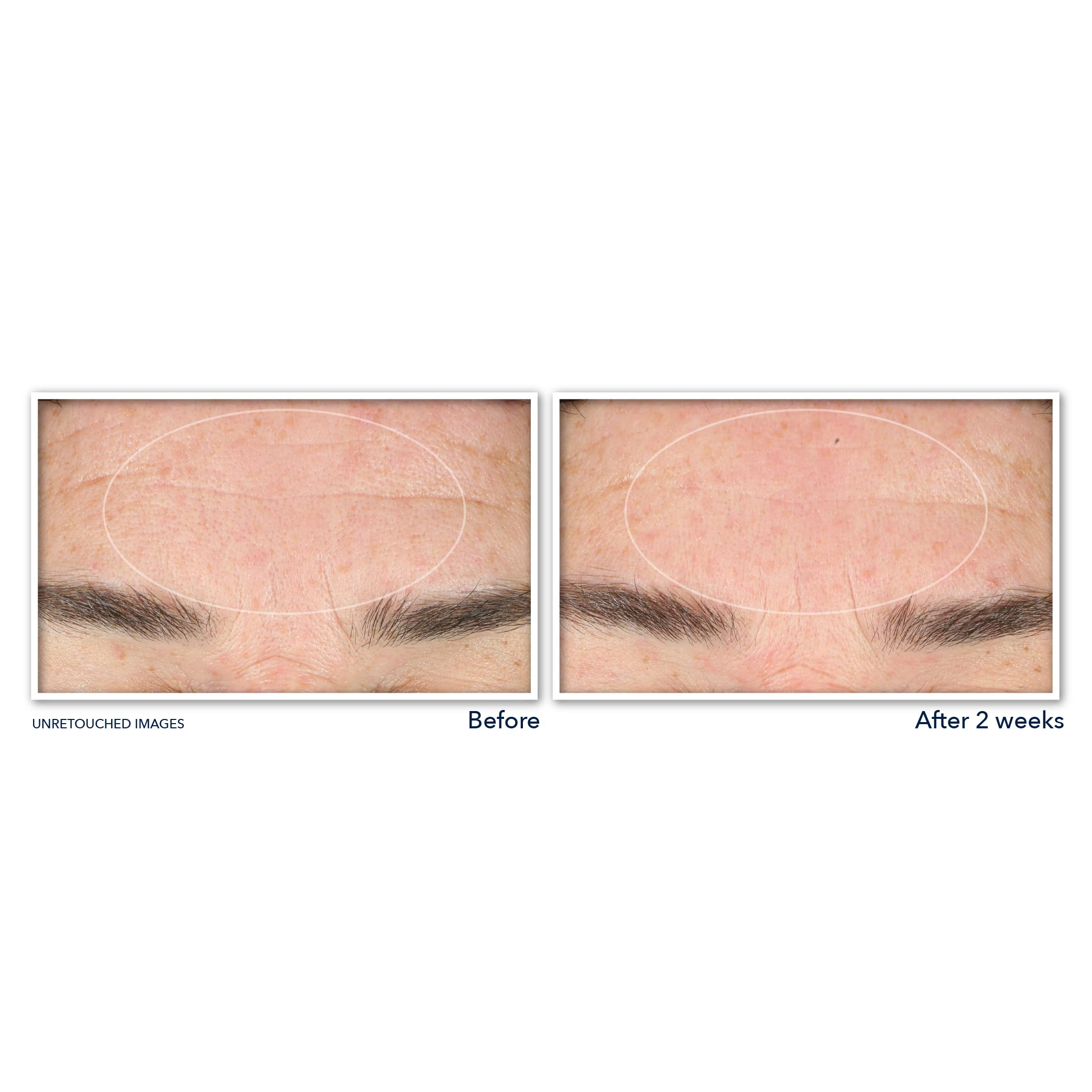 RoC Derm Correxion Serum Facial Cleanser with Niacinamide and Amino Acids
