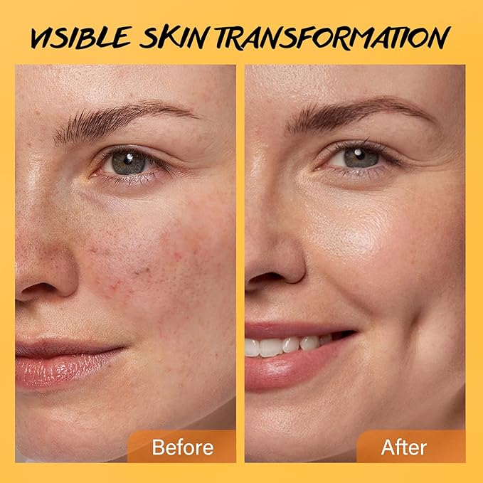 Exfoliating Face Scrub with Turmeric and Vitamin C Face Exfoliator Scrub Powder for Exfoliation Dullness Acne Blackheads Oiliness Exfoliating Face Wash for Women Clean Moisturizes Soothes Amino Acid