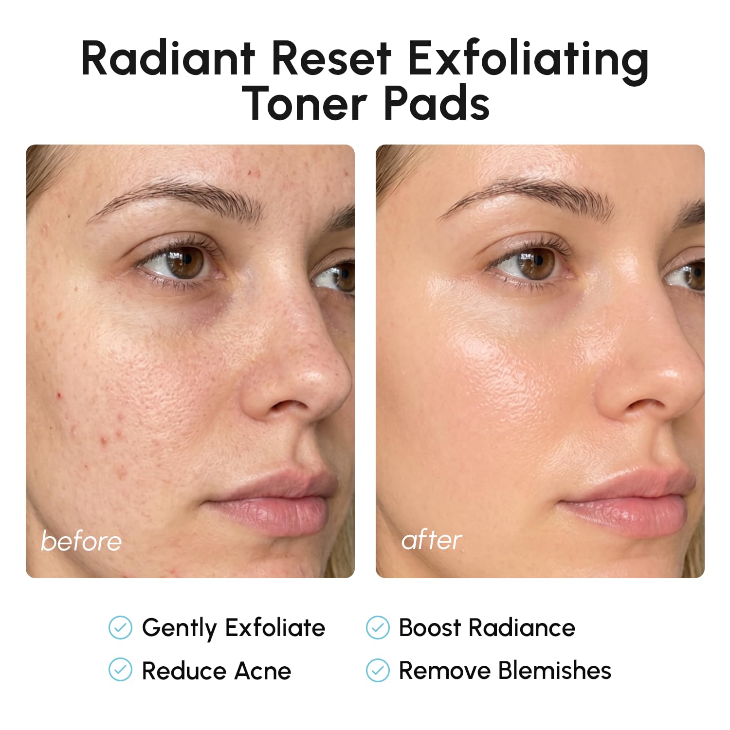 MAREE Glycolic Acid Pads - Toner Pads for Face Cleansing - Exfoliating Pad with Tea Tree Oil, Salicylic Acid & Vitamins E, B3, B5 - Facial Polishes & Peels, Skin Pore Resurfacing & Radiance - 50 Count