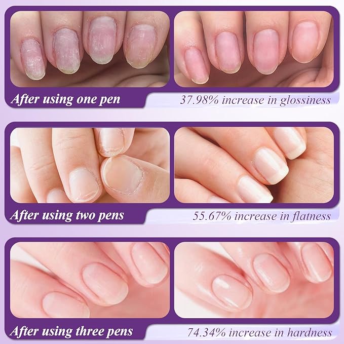 Plman 3-in-1 Cuticle Oil Pen, Cuticle Pusher Nail Oil Pen with Ceramic Tip, Nail Care Pen for Hangnails, Dry & Damaged Nail, Moisturize Strengthen Brighten Nails Care (Camellia-3PCS Rotating)