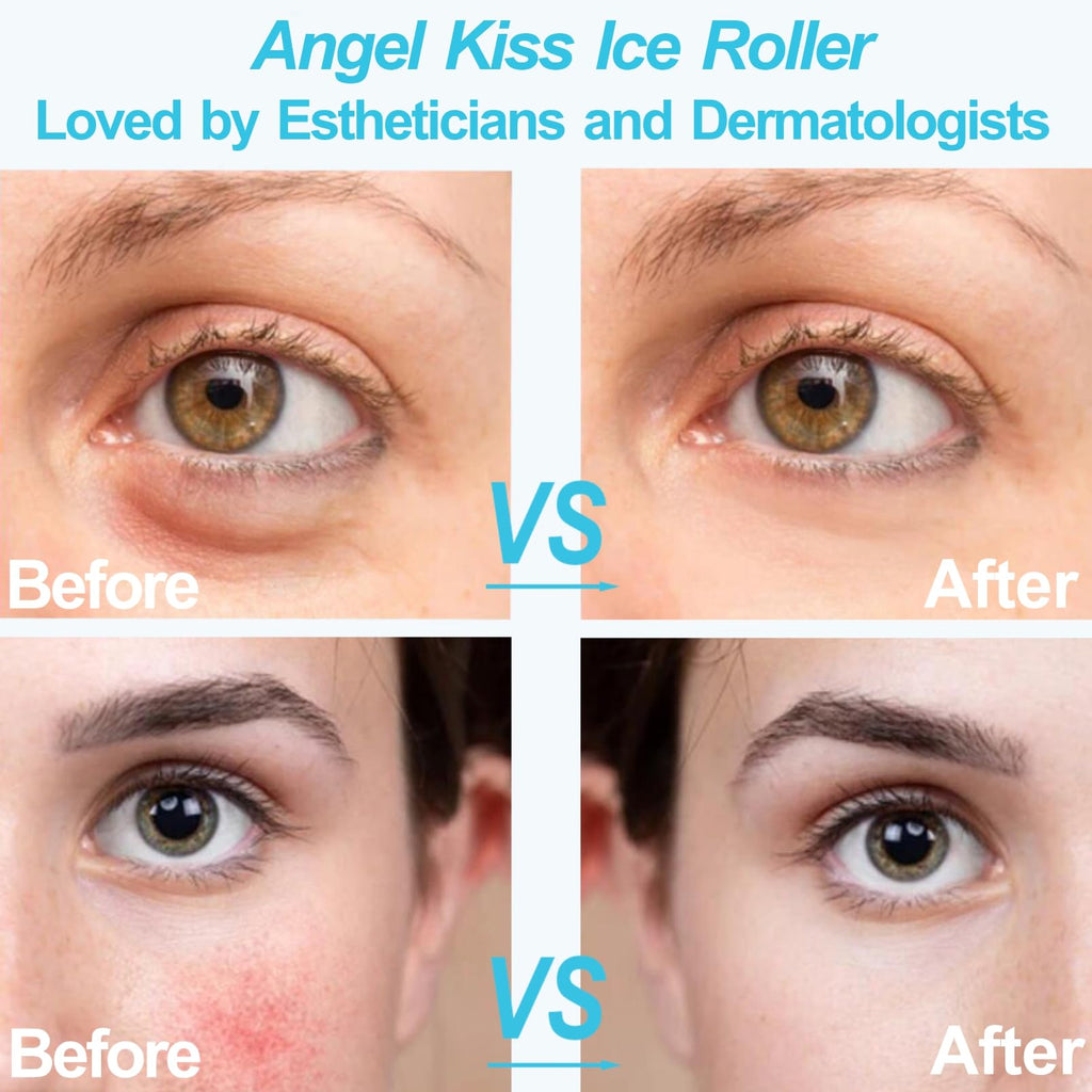 Angel Kiss Ice Roller for Face Eye - Women Gift Idea - Facial Massage Tool