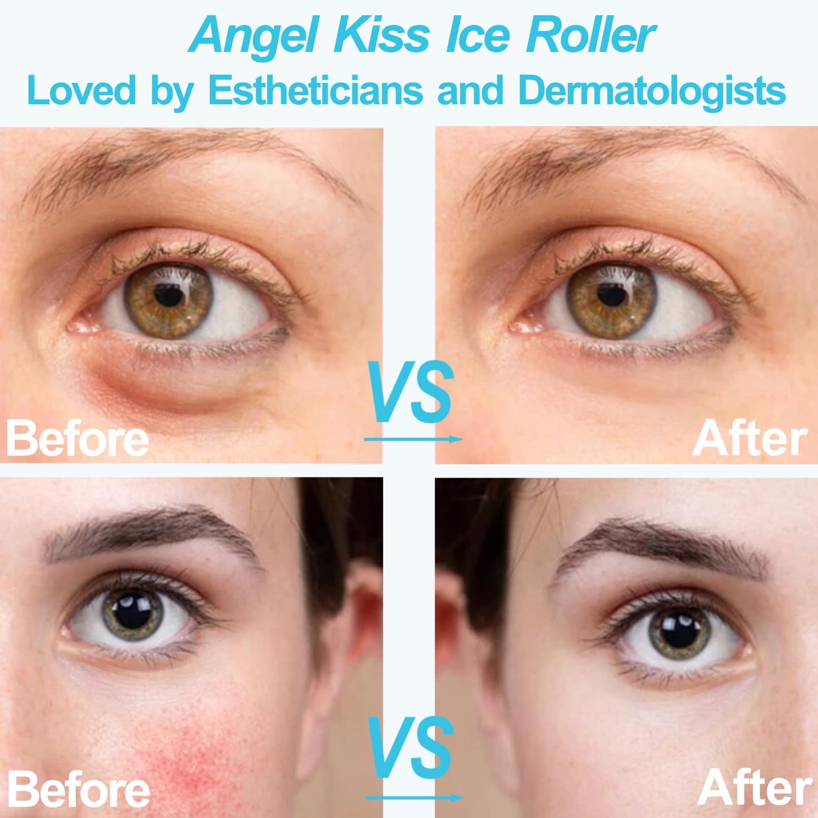 Angel Kiss Ice Roller for Face Eye - Women Gift Idea - Facial Massage Tool