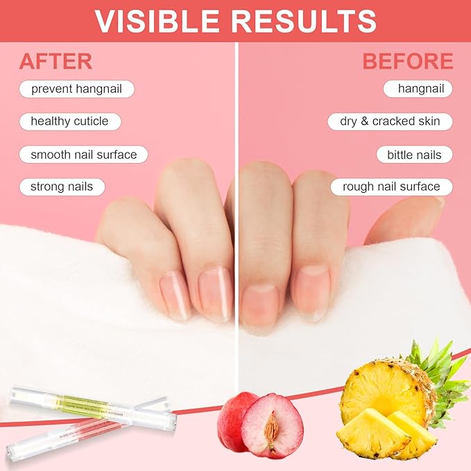 3PCS Nail Cuticle Oil Pens with Nail File, Natural Cuticle Oil for Nail Care, Moisturizing Nail Oil for Dry Nails & Cuticles (Pineapple & Peach & Jasmine Scent)
