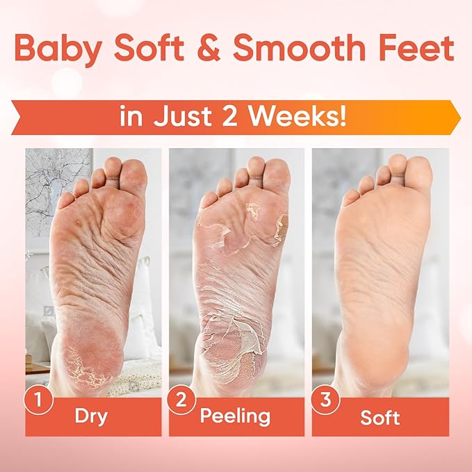CÉLOR Foot Peeling Mask for Dry Cracked Feet | Foot Mask to Exfoliate Rough, Cracked, Dry Feet, Calluses for Soft Baby Feet Results | Made with Aloe Vera Extract for Women & Men (5 Pairs) | Peach