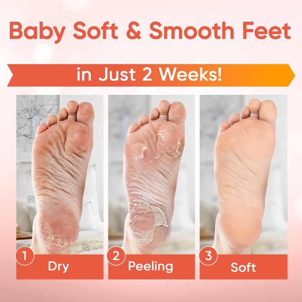 CÉLOR Foot Peeling Mask for Dry Cracked Feet | Foot Mask to Exfoliate Rough, Cracked, Dry Feet, Calluses for Soft Baby Feet Results | Made with Aloe Vera Extract for Women & Men (5 Pairs) | Peach