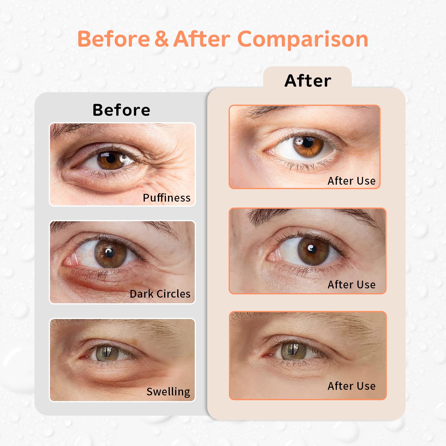 Conbella 4PCS Gel Eye Ice Pack Set Reusable, Cold and Hot Compress for Eyes