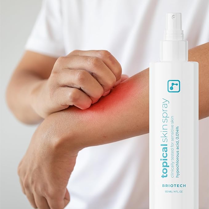 BRIOTECH Topical Skin Spray, Hypochlorous Acid Spray for Sensitive Skin, HOCl Facial Mist, Full Body Support Against Irritation, Calm Redness, Soothe Foot & Scalp, 8.5 oz (4 Pack)