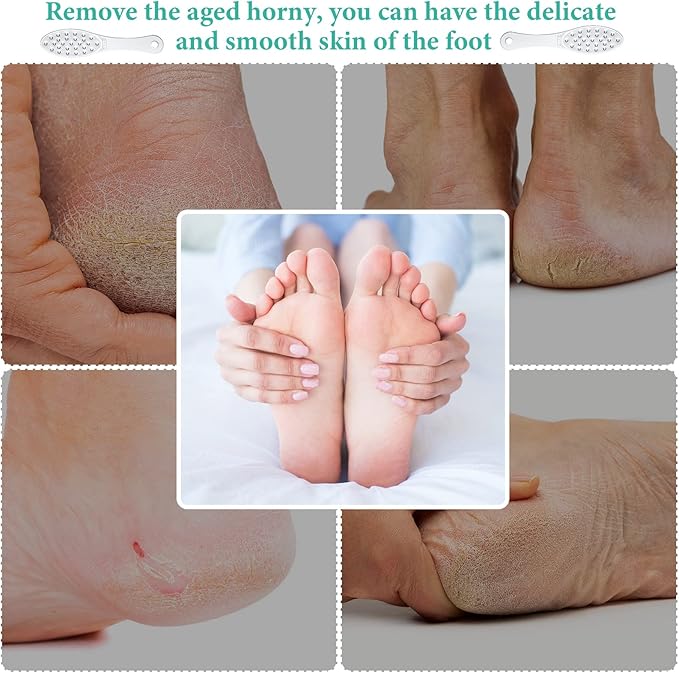 1 Pc Stainless Steel Foot Scraper Metal Foot File Double Sided File Callus Remover Professional Feet Rasp Scrubber for Wet or Dry Skin Easy to Clean Pedicure Tool Heel