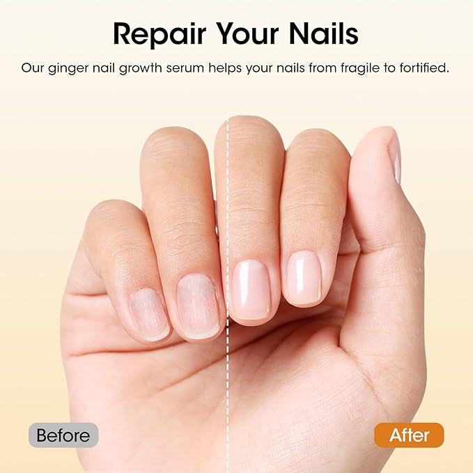 Gellen 7-14 Days Ginger Nail Growth Serum for Nail Strengthener and Growth, Nail Repair Treatment for Weak Brittle Splitting Damaged Nails, Hydrated & Nourished Nail Care Solution for Hands & Feet