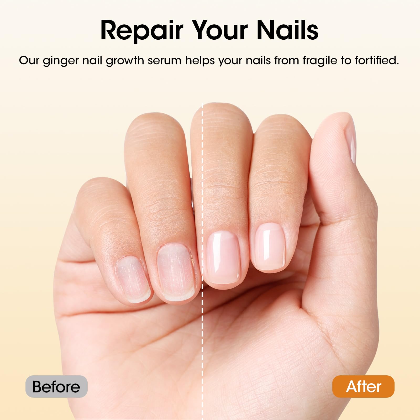 GELLEN 7-14 Days Ginger Nail Growth Serum for Nail Strengthener and Growth, Nail Repair Treatment for Weak Brittle Splitting Damaged Nails, Hydrated & Nourished Nail Care Solution for Hands & Feet