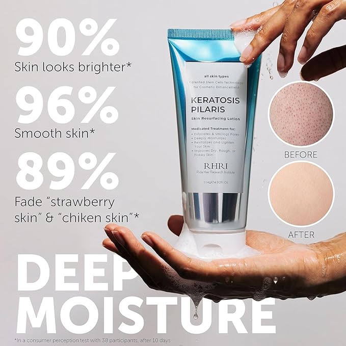 KP Bump Eraser Body Scrub with 10% AHA | Keratosis Pilaris Treatment | Bump Eraser Body Scrub | Clears Strawberry Legs | Soothes Redness, Dryness & Flaky Skin