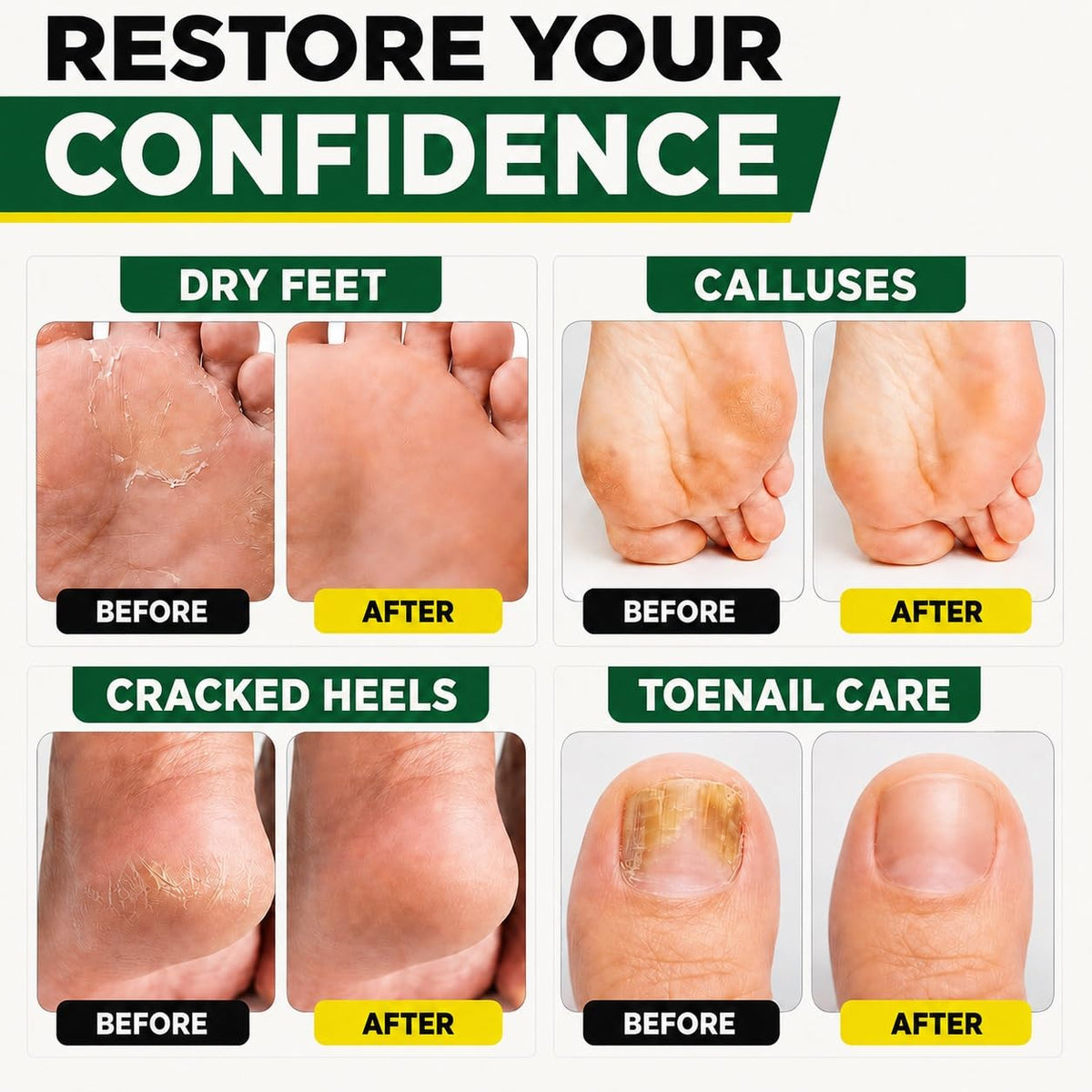 Tea Tree Oil Foot Soak for Foot Bath and Foot Soaking Tub, 16 oz