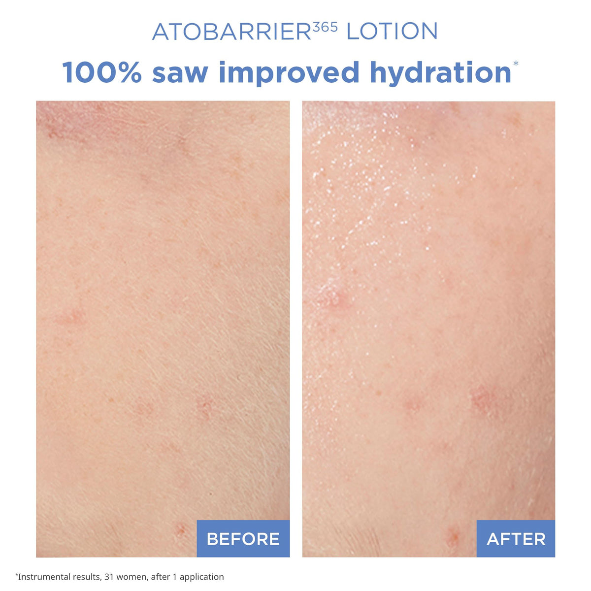 AESTURA ATOBARRIER365 Lightweight Korean Face Moisturizer with Ceramides | Strengthens Barrier, Fast-Absorbing Hydration, Suitable for Dry, Normal & Sensitive Skin, 150ML / 5.07 fl. Oz.