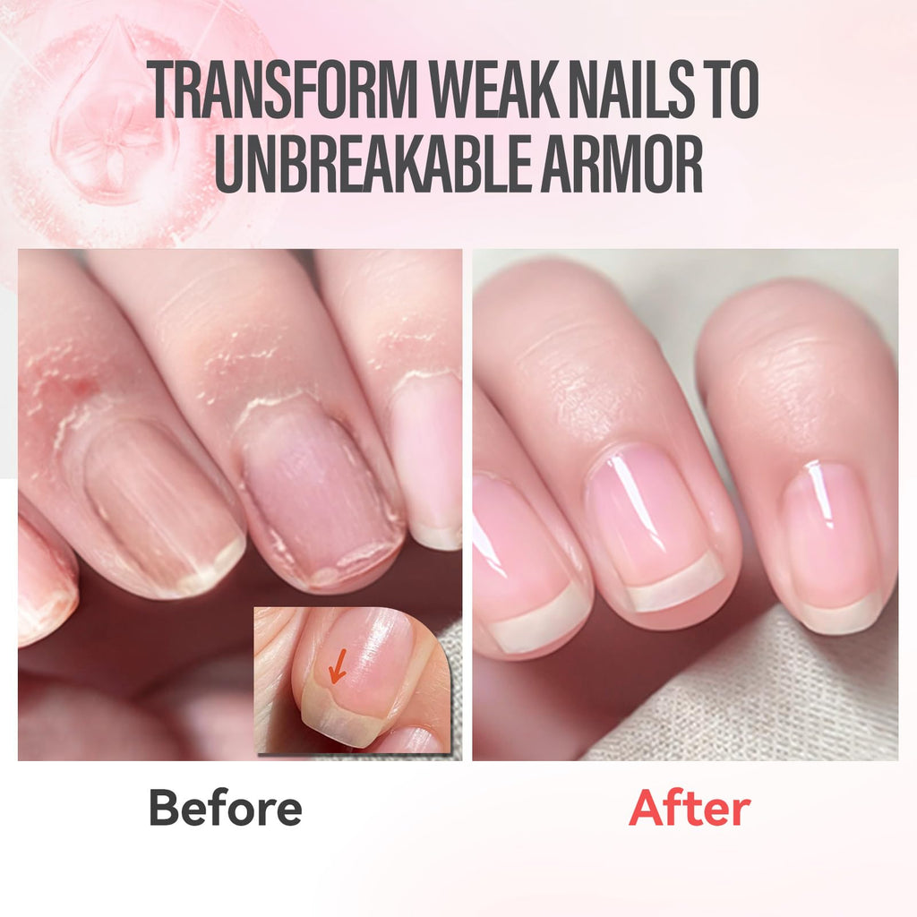 CHUCHU Vegan Cuticle Oil for Nails: Rose Jojoba Nail Cuticle Oil with Vitamin B & E for Moisturizes Cuticle and Nail's Skin - Prevents Hangnails and Chapped 15ML