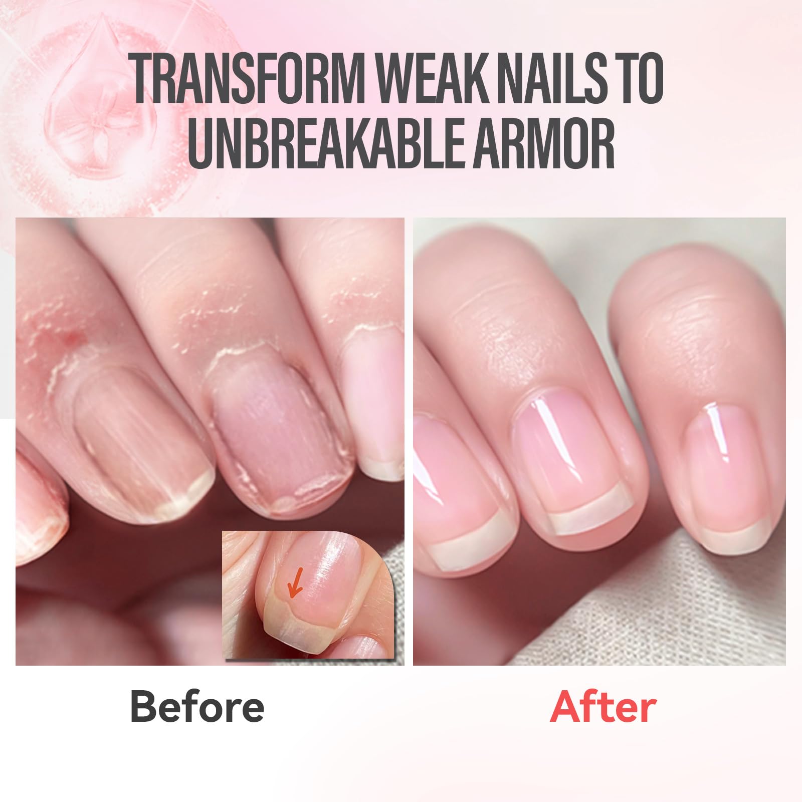 CHUCHU Vegan Cuticle Oil for Nails: Rose Jojoba Nail Cuticle Oil with Vitamin B & E for Moisturizes Cuticle and Nail's Skin - Prevents Hangnails and Chapped 15ML