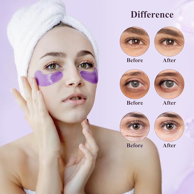 Taimand Under Eye Patches (30 Pairs), Under Eye Mask for Puffy Eyes and Dark Circles, Eye Masks with Collagen, Relieves Pressure and Reduces Wrinkles, Revitalises and Refreshes Your Skin, Lavender