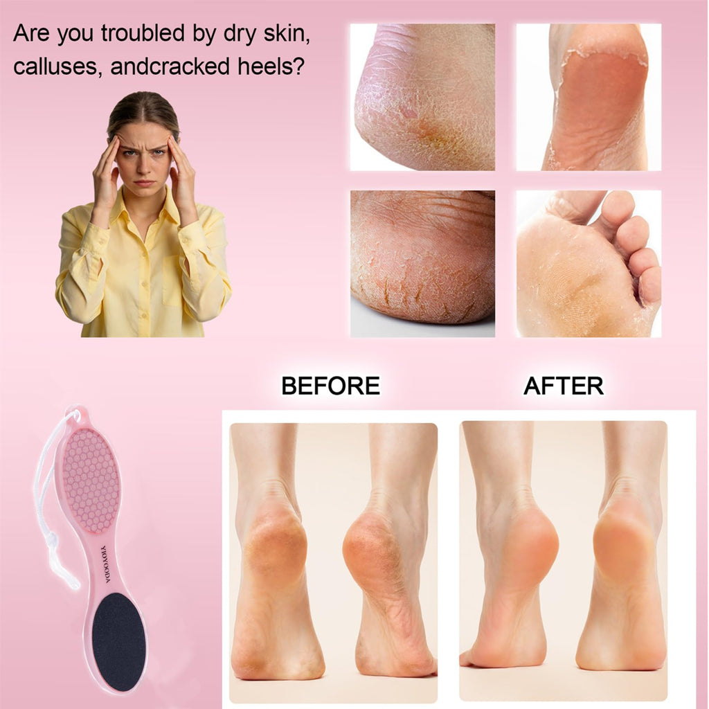 YIOYOODA 4-in-1 Nano Glass Foot Callus Remover, Professional Foot File (Glass, Rasp & Sand Paper), Durable Foot Scrubber Pedicure Tools for Hard and Dead Skin Remover, Soft Smooth Feet, 2 Pcs Pink