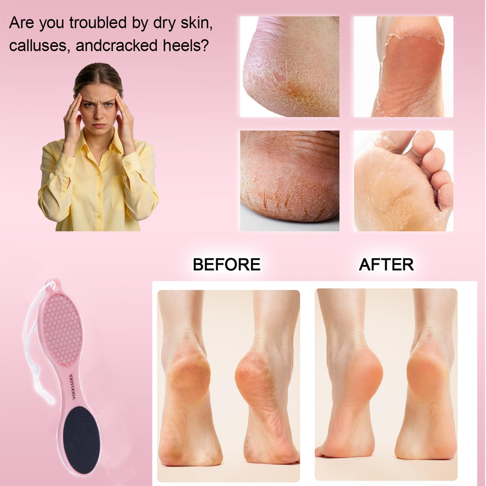 YIOYOODA 4-in-1 Nano Glass Foot Callus Remover, Professional Foot File (Glass, Rasp & Sand Paper), Durable Foot Scrubber Pedicure Tools for Hard and Dead Skin Remover, Soft Smooth Feet, 2 Pcs Pink
