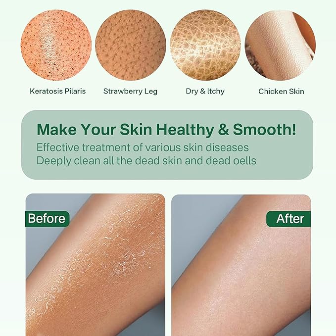 Yiclick Heavy Exfoliating Gloves, Exfoliating Body Scrubber for Bath Shower Exfoliation, Body Scrub Exfoliator for Dead Skin Remover, Exfoliate Sponge Loofah Washcloth Mitt Men Women