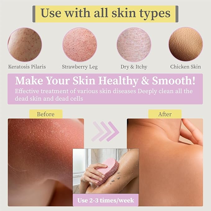 Magic Exfoliating Bath Sponge, 3D Super Soft Exfoliating Bath Sponge, Skin Friendly and Reusable for Adults Children and Pregnant Women Alternative to exfoliating Gloves (Pink + Yellow + Gray)