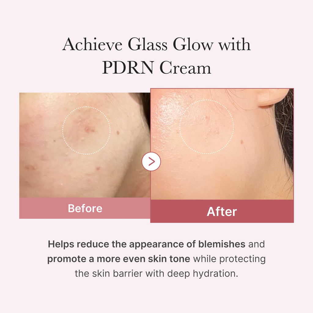 medicube Salmon DNA PDRN Pink Hyaluronic Moisturizing Cream