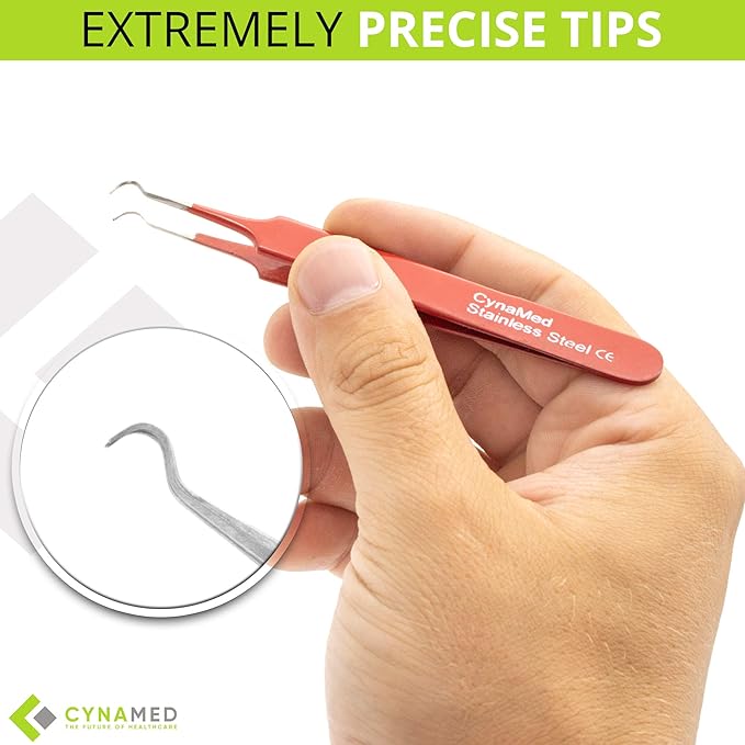 Blackhead Tweezer - Professional Curved Steel Tip Surgical Comedone & Splinter Extractor. Ideal Blemish & Acne Remover Tool Means Flawless Facial Skin (Red)