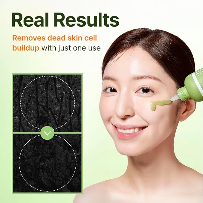 CENTELLIAN 24 Madeca Matcha Peeling Gel (5.07fl oz) – Gentle Exfoliator for Clear, Smooth & Balanced Skin, Korean Skin Care. Matcha-TECA Complex, Charcoal Capsules.