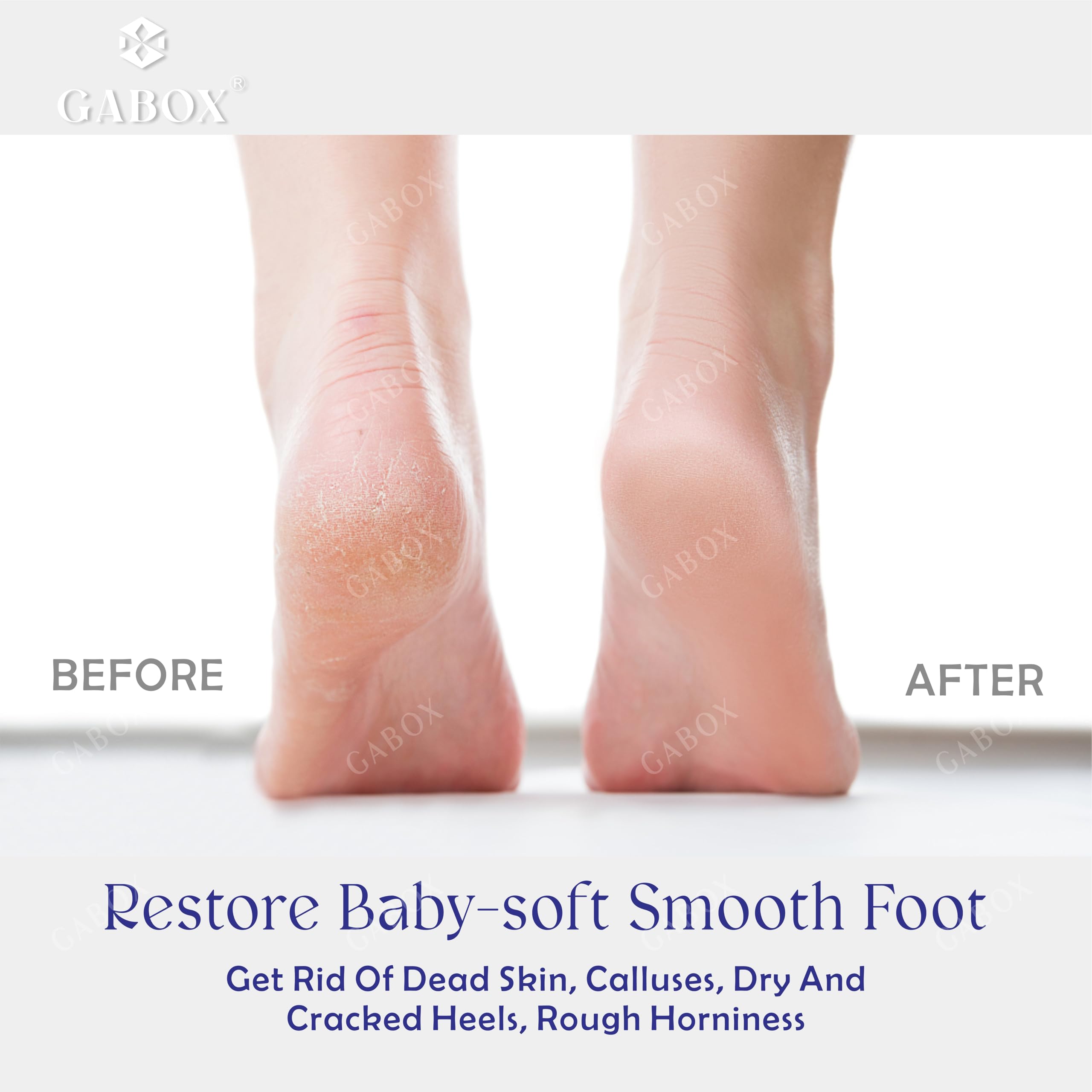 GABOX Nano Glass Pro Foot File, Feet Callus Remover, Dead Skin Exfoliator